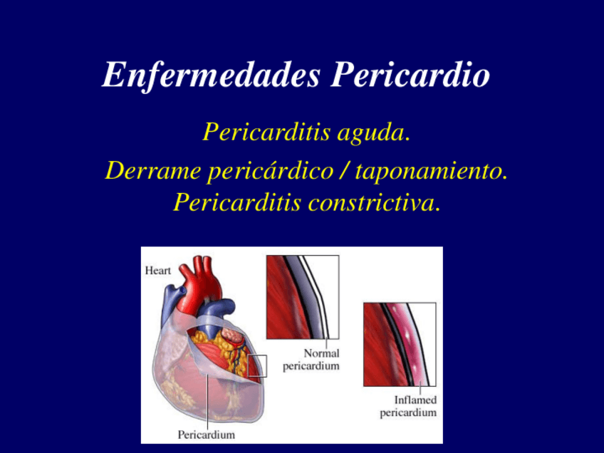 Miniatura del documento 17.-Enfermedades-pericardio.pdf