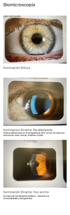 Miniatura del documento Biomicroscopia-entra-en-Examen.pdf