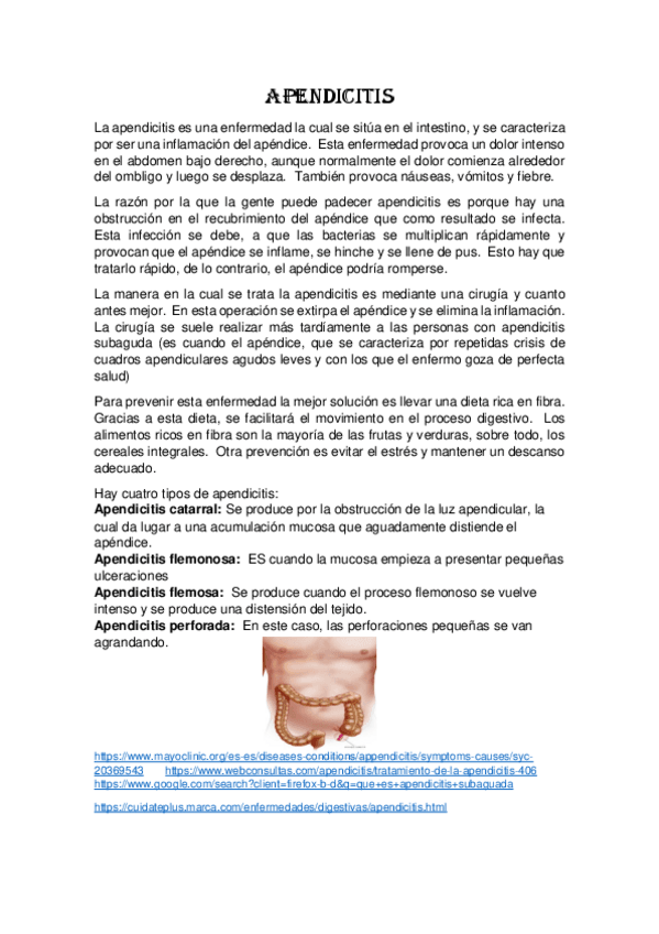 Miniatura del documento APENDICITIS.pdf