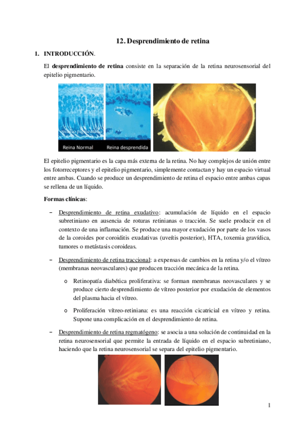 Miniatura del documento 12.-Desprendimiento-de-retina.pdf