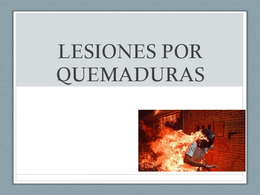 Miniatura del documento Quemaduras.pdf