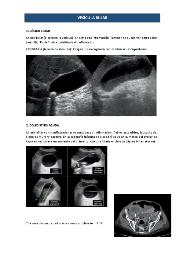 Miniatura del documento via-biliar-y-pancreas-2-parcial-2022-Carla.pdf