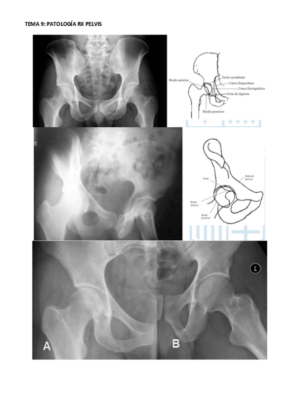 Miniatura del documento RADIODIAGNOSTICO-P3.pdf