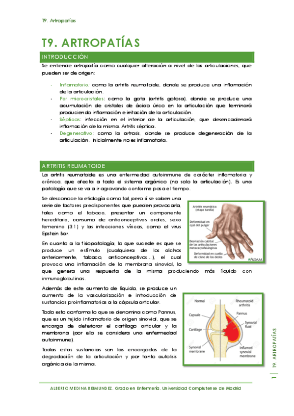 Miniatura del documento T9. Artropatías.pdf
