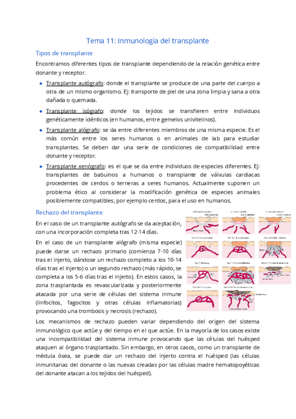 Miniatura del documento Tema-11.-Inmunologia-del-transplante.pdf