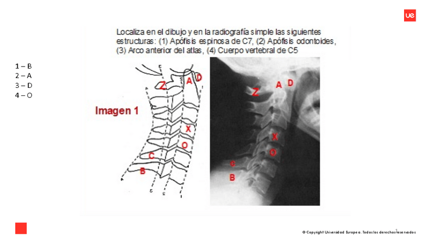 Miniatura del documento PRACTICAS-TRONCO.pdf