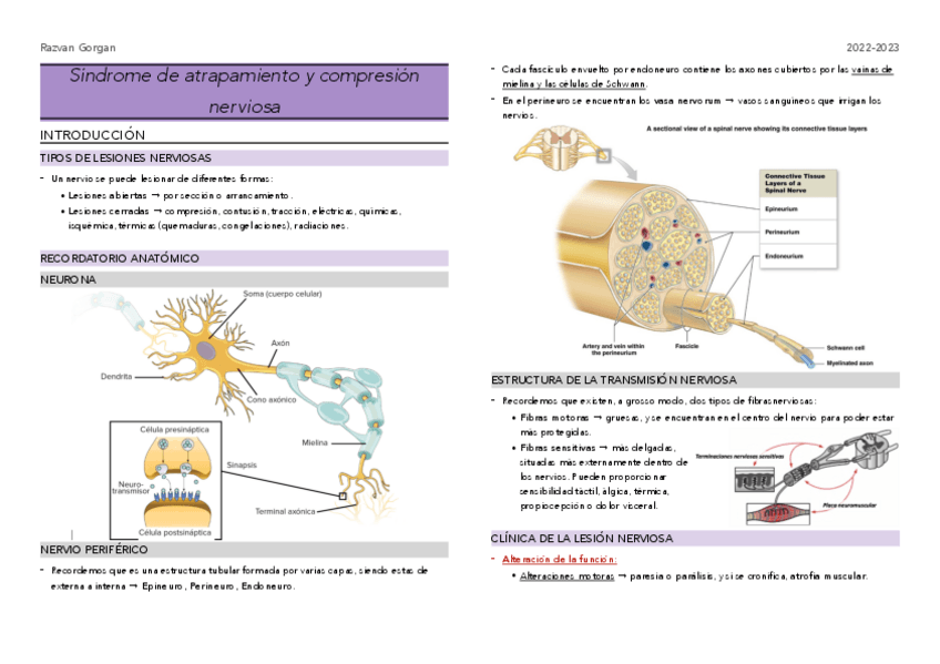 Miniatura del documento T5-Sindrome-compresion--compartimental.pdf
