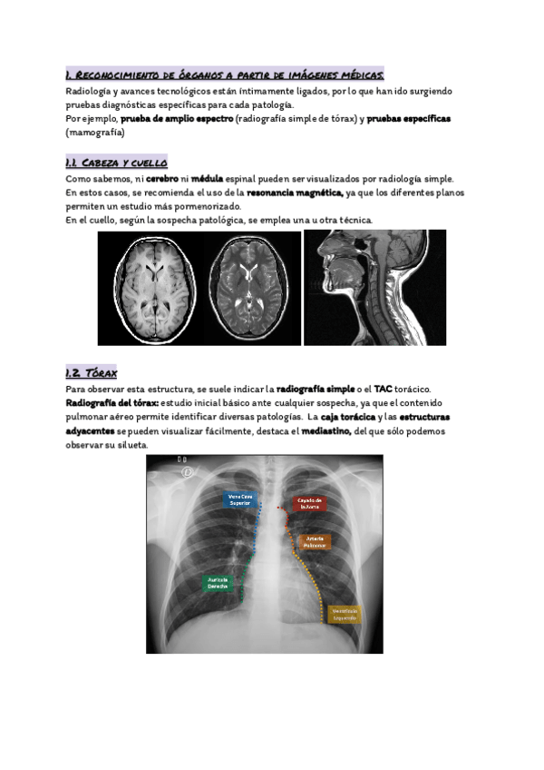 Miniatura del documento TEMA-3.-Reconocimiento-de-organos-a-partir-de-imagenes-medicas.pdf