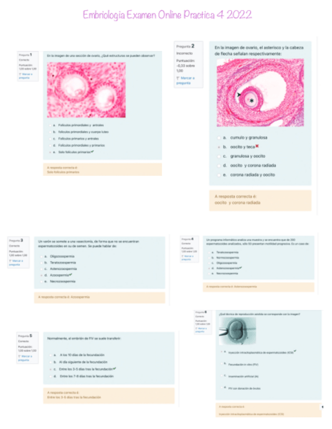 Miniatura del documento Embriologia-Examen-Practica-4-Online-2022.pdf