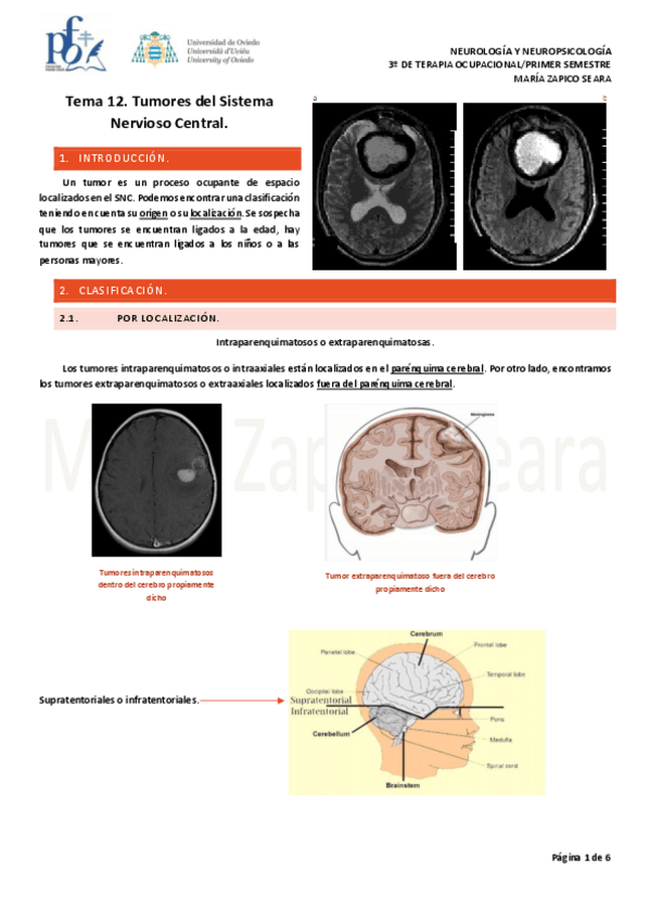 Miniatura del documento Tema-12.-Tumores-del-SNC.pdf