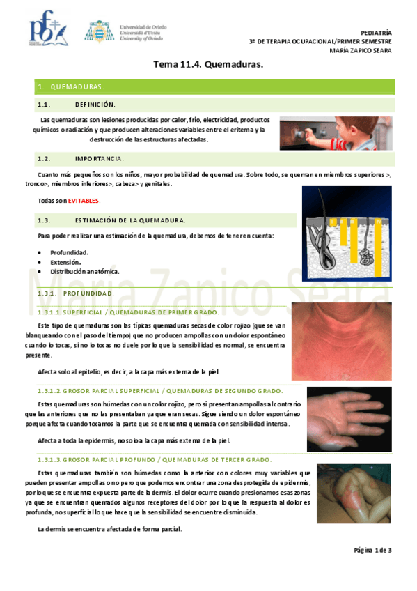 Miniatura del documento Tema-11.4.-Quemaduras.pdf