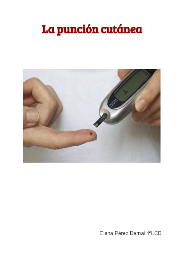 Miniatura del documento La-puncion-cutanea.pdf