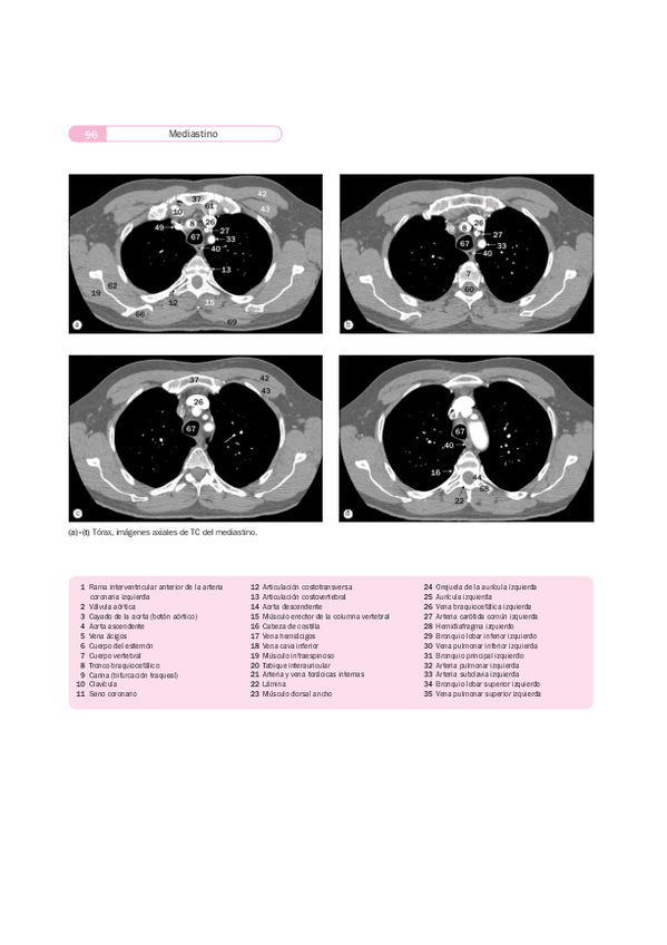 Miniatura del documento Imágenes radiológicas TAC RM.pdf