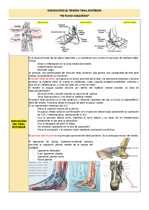 Miniatura del documento Disfuncion-del-tendon-tibial-posterior.pdf