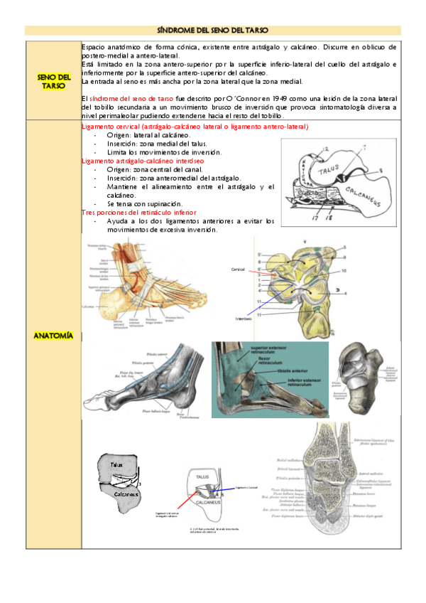 Miniatura del documento Sindrome-del-seno-del-tarso.pdf