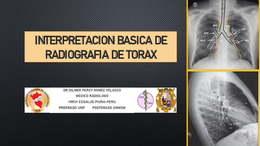 Miniatura del documento INTERPRETACION-BASICA-DE-RADIOGRAFIA-DE-TORAX.pdf
