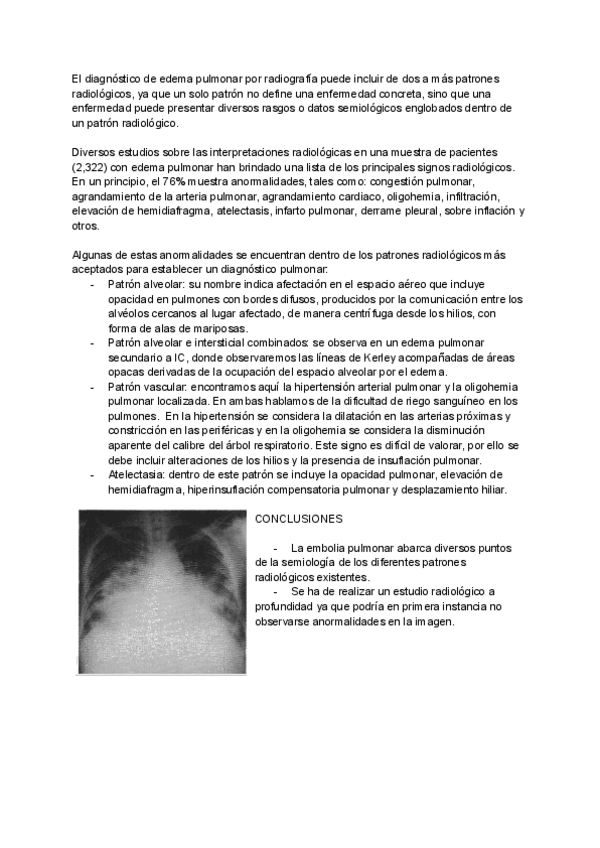 Miniatura del documento MONOGRAFIA-EDEMA-PULMONAR.pdf