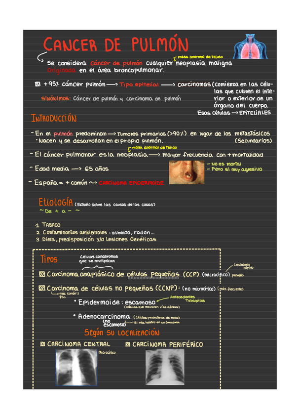 Miniatura del documento Cancer-de-pulmon.pdf