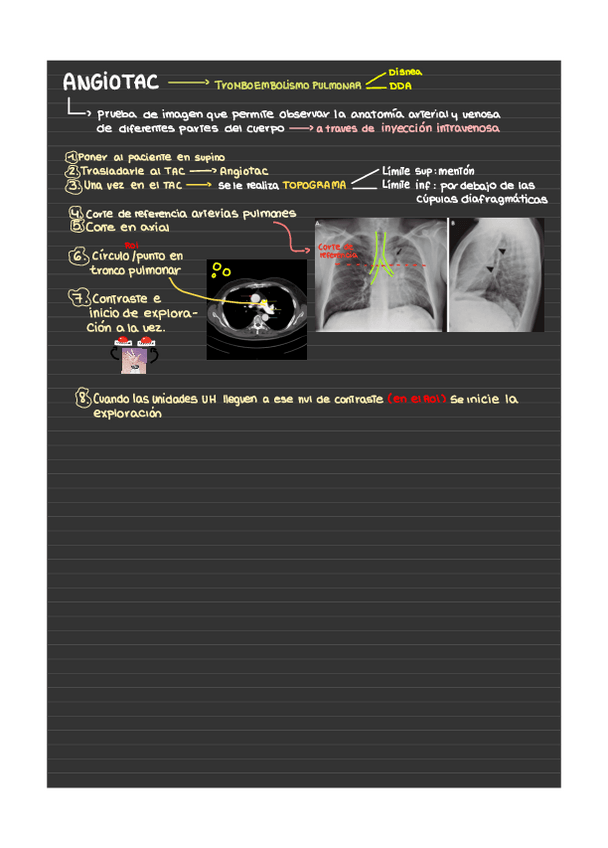 Miniatura del documento Angiotac-explicacion-proceso.pdf