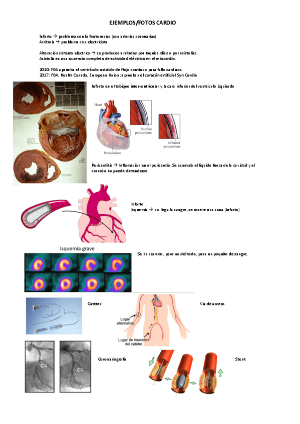 Miniatura del documento ejemplos-cardio.pdf