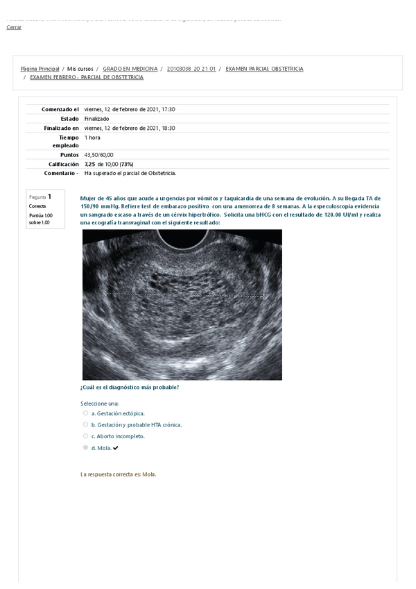Miniatura del documento EXAMEN-FEBRERO-PARCIAL-DE-OBSTETRICIA-2021.pdf