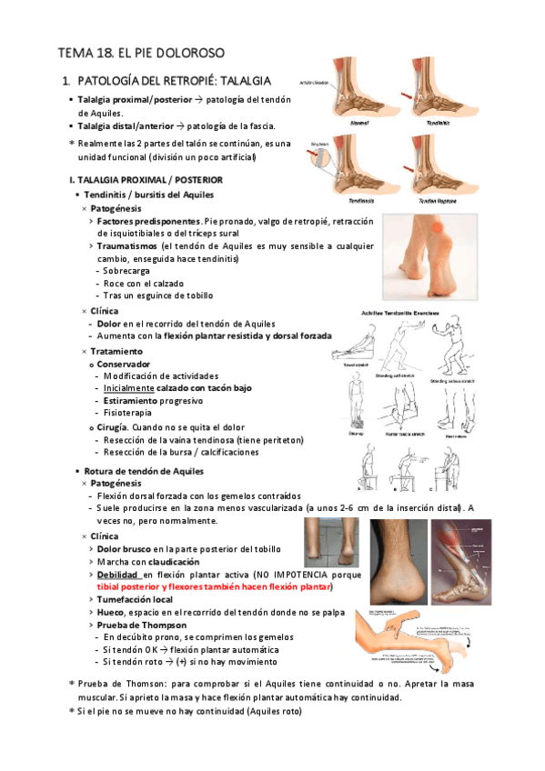 Miniatura del documento T18.-El-pie-doloroso.-Talalgia-y-metatarsalgia..pdf