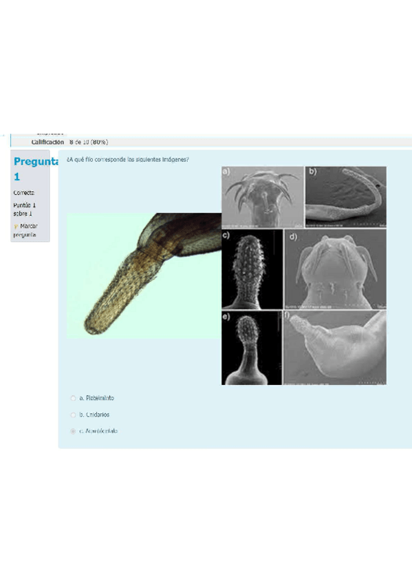 Miniatura del documento Cuestionario P3 Platelmintos CORREGIDO.pdf