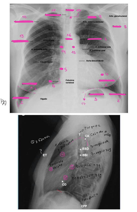 Miniatura del documento Actividad-Clase-2-UT5.pdf