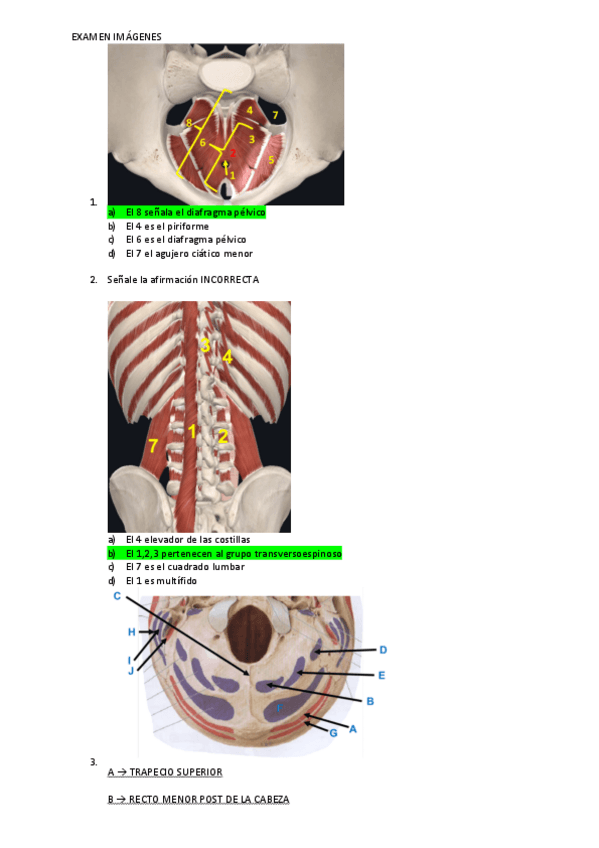 Miniatura del documento EXAMEN-IMAGENES-2021-22.pdf