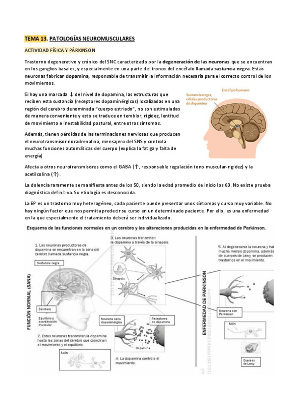 Miniatura del documento Tema13.-Patologias-Neuromusculares.pdf