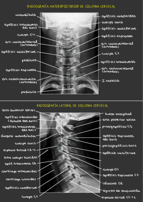Miniatura del documento Radiografias-TCC.pdf