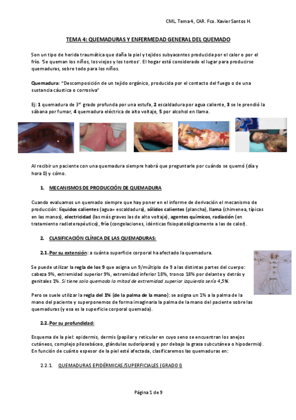 Miniatura del documento TEMA-4-car-quemaduras.pdf