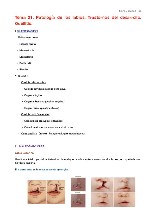 Miniatura del documento Tema 21.pdf