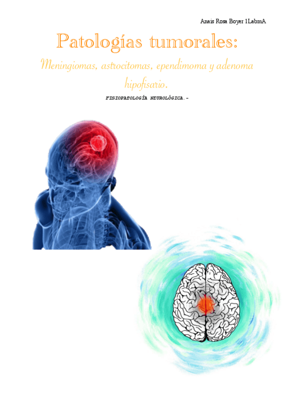 Miniatura del documento Trabajo-Fisiopatologia-Patologias-tumorales-Meningiomas-astrocitomas-ependimoma-y-adenoma-hipofisario.-Anais-Rosa-Boyer-1LabmA.pdf