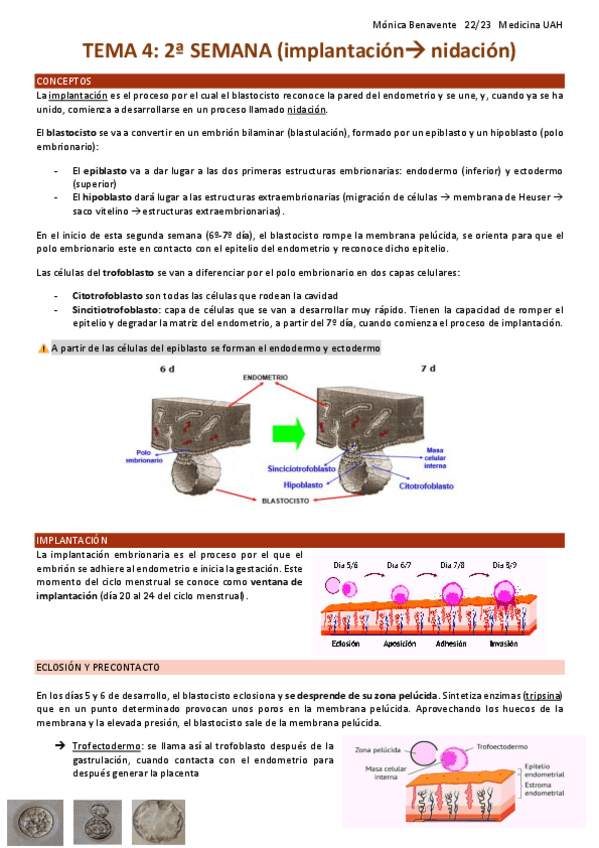 Miniatura del documento TEMA-4-2a-semana.pdf