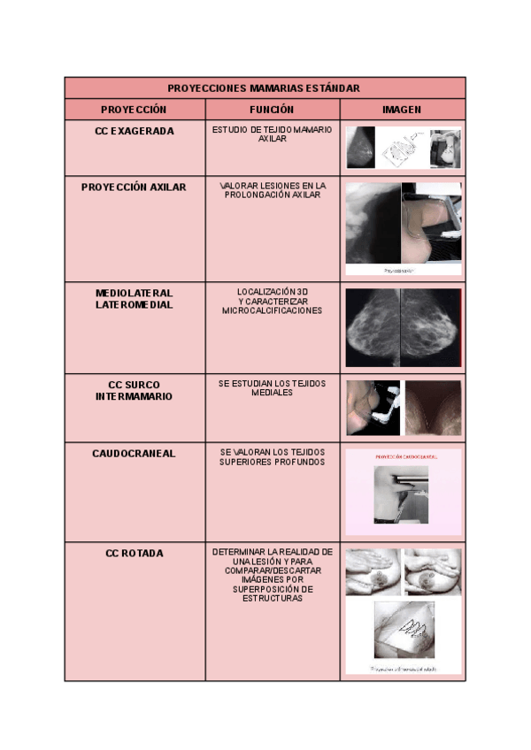 Miniatura del documento PROYECCIONES-MAMARIAS-ESTANDAR.pdf