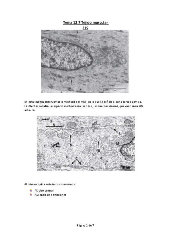 Miniatura del documento Tema-12.8-Tejido-muscular-liso.pdf