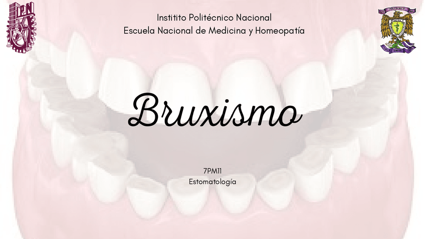 Miniatura del documento Bruxismo.pdf