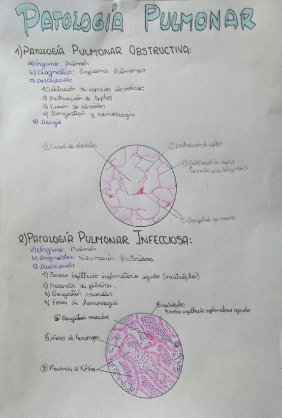 Miniatura del documento Patologia-pulmonar.pdf