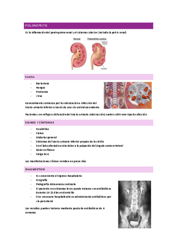 Miniatura del documento Pielonefritis.pdf