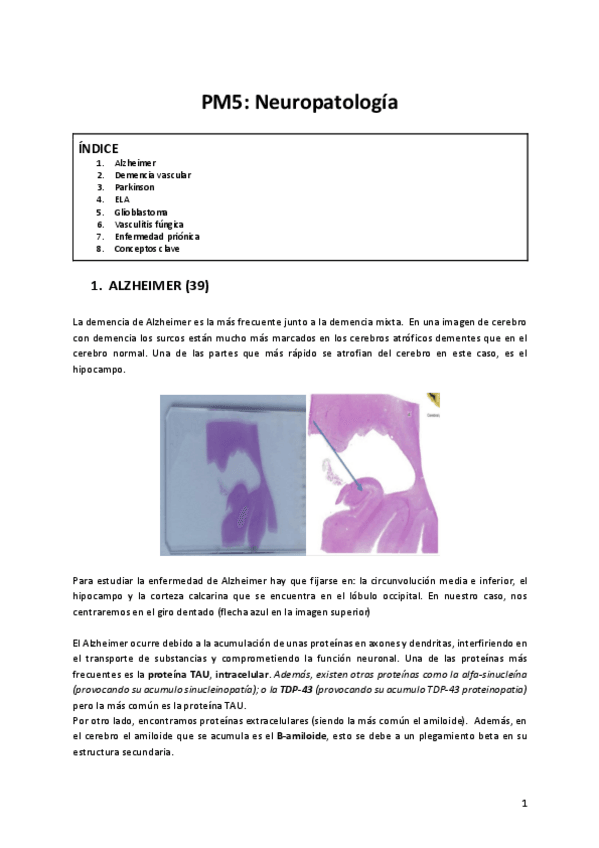 Miniatura del documento Practica-5-Neuropatologia.pdf