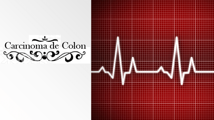 Miniatura del documento Cancer-Colorrectal.pdf