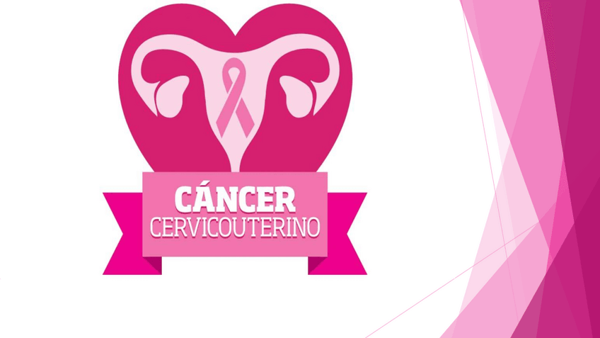 Miniatura del documento Cancer-cervicouterino.pdf
