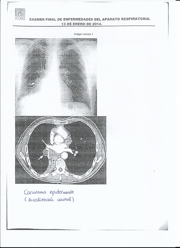 Miniatura del documento EXAMEN Respiratorio - Convocatoria Enero 2014 - CORREGIDO 7.jpg
