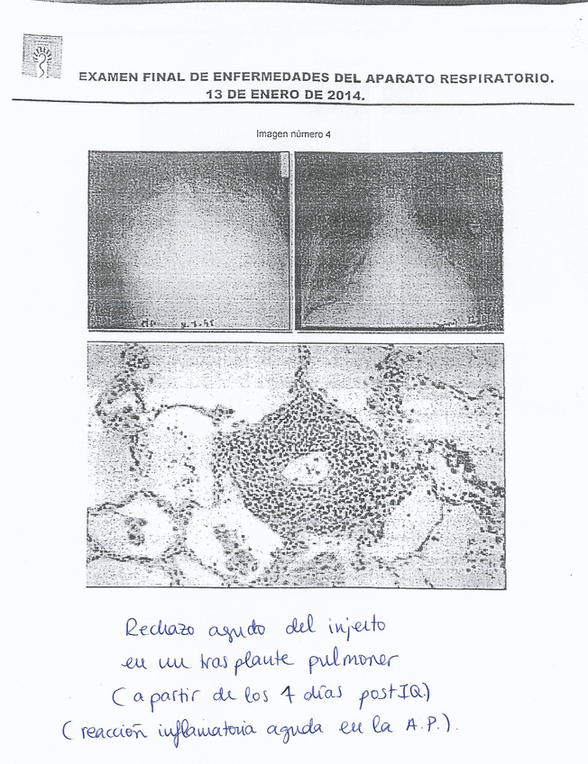 Miniatura del documento EXAMEN Respiratorio - Convocatoria Enero 2014 - CORREGIDO 10.jpg