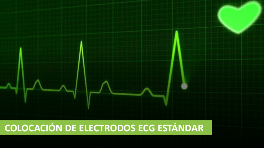 Miniatura del documento COLOCACION-DE-ELECTRODOS-ECG-ESTANDAR.pdf
