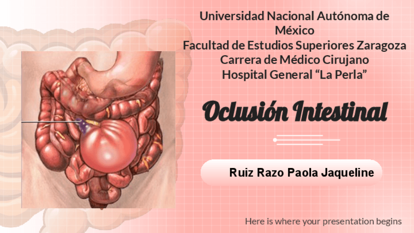 Miniatura del documento Oclusion-Intestinal.pdf