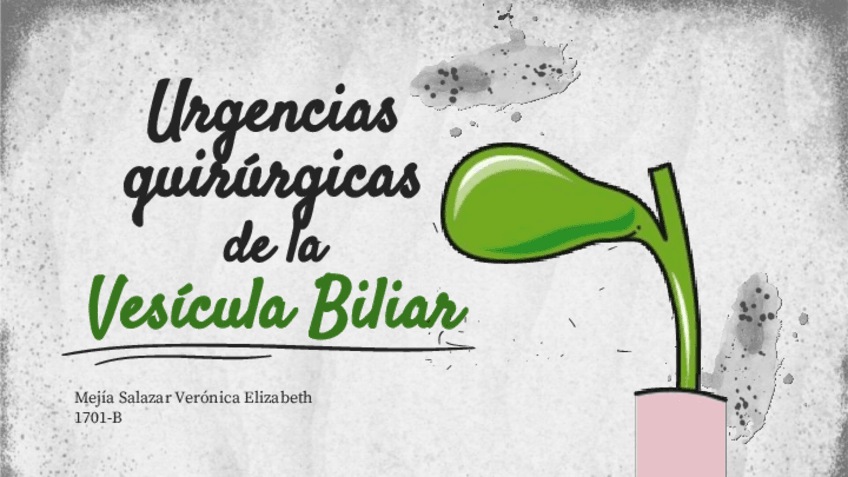 Miniatura del documento Urgencias-Qx-de-Vesicula..pdf