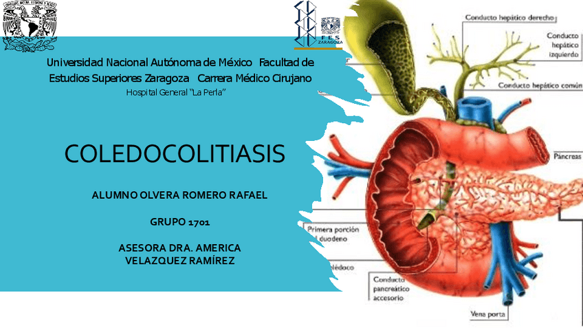 Miniatura del documento COLEDOCOLITIASIS.pdf