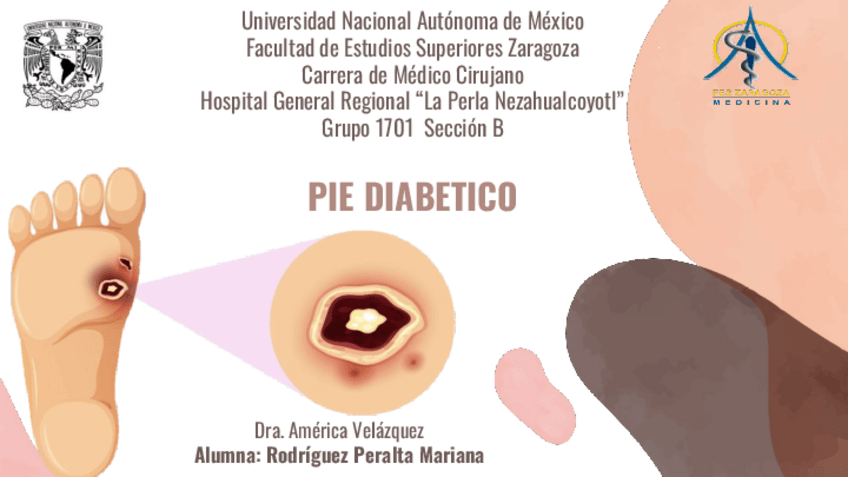Miniatura del documento Pie-Diabetico.pdf